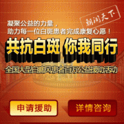 脸上白癜风病怎么办